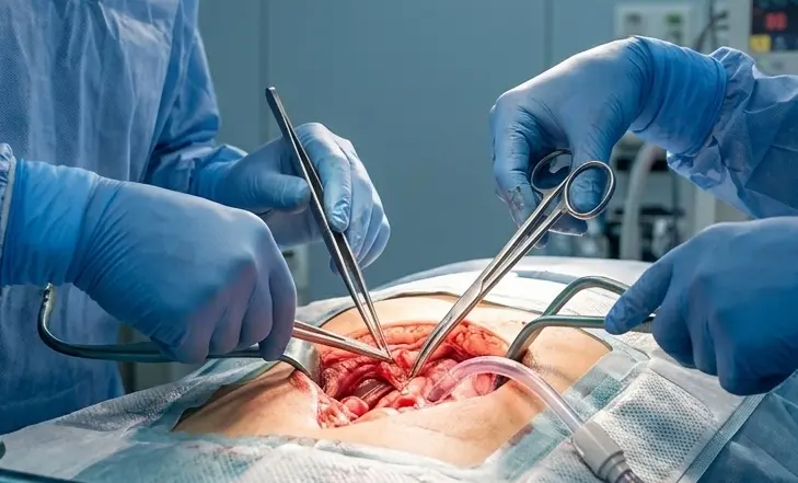 Surgical Instruments Manufacturer Pakistan